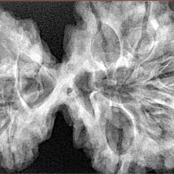 9 MK Gaurishankar 42.6mm 9.73gm - Xray