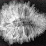 20 Mukhi Rudraksha 29.9mm 5.67gm - Xray
