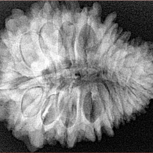 20 Mukhi Rudraksha 29.9mm 5.67gm - Xray