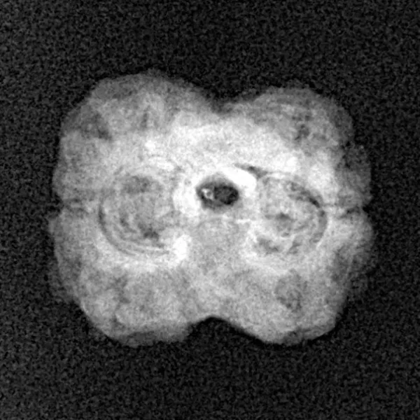 2 Mukhi Rudraksha 22.5mm 1.76gm - Xray