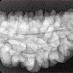 1 Mukhi Rudraksha 36.2mm 5.32gm - Xray