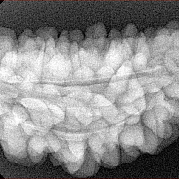 1 Mukhi Rudraksha 36.2mm 5.32gm - Xray
