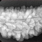 1 Mukhi Rudraksha 35.8mm 6.05gm - Xray