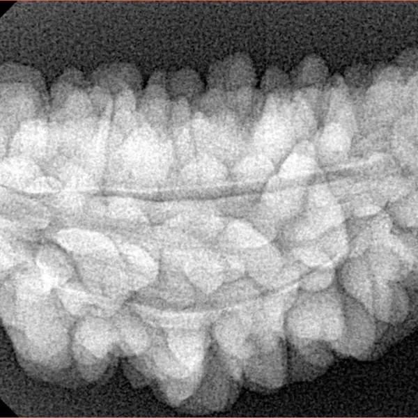 1 Mukhi Rudraksha 35.8mm 6.05gm - Xray