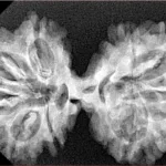 9 MK Gaurishankar 36.7mm 5.7gm - Xray