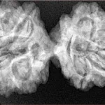 11 MK Gaurishankar 38.7mm 7.22gm - Xray