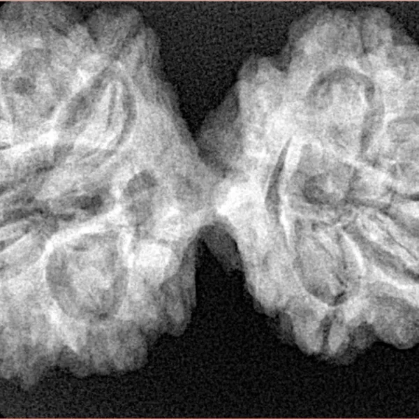 11 MK Gaurishankar 38.7mm 7.22gm - Xray