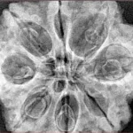 8 Mukhi Rudraksha 31.6mm 7.94gm - Origin: Nepal - Xray