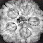 5 Mukhi Rudraksha 29.6mm 9.58gm - Xray