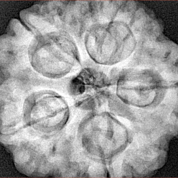 5 Mukhi Rudraksha 29.6mm 9.58gm - Xray