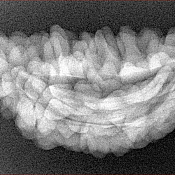 1 Mukhi Rudraksha 34.5mm 4.42gm - Xray