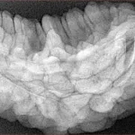 1 Mukhi Rudraksha 34.9mm 6.75gm - Xray