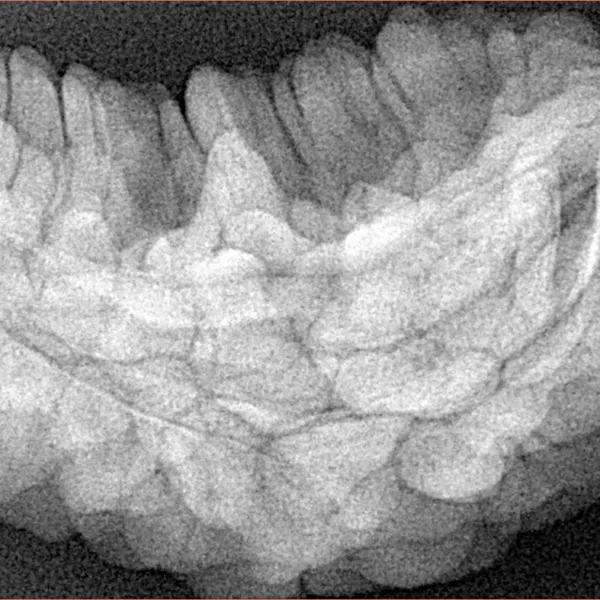 1 Mukhi Rudraksha 34.9mm 6.75gm - Xray