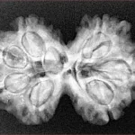 7 MK Gaurishankar 30.3mm 5.11gm - Xray