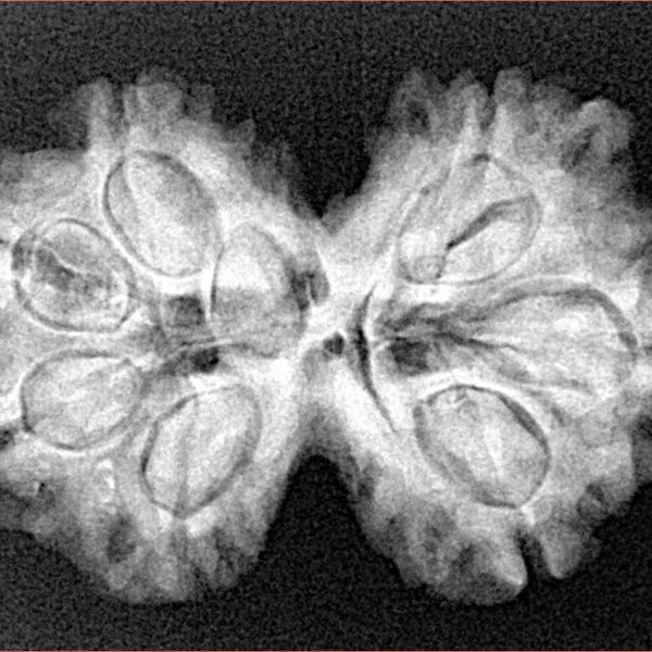 7 MK Gaurishankar 30.3mm 5.11gm - Xray