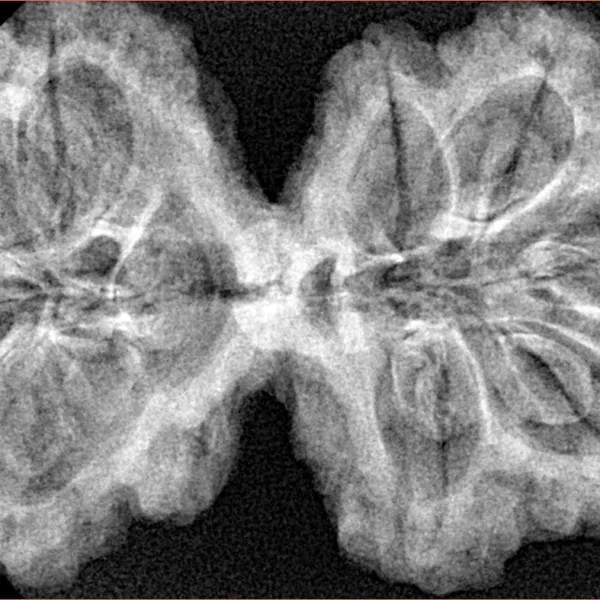 9 MK Gaurishankar 39.3mm 7.49gm - Xray