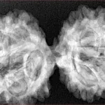 10 Mk Gaurishankar 41mm 8gm - Xray
