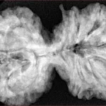 9 MK Gaurishankar 40.3mm 9.7gm - Xray