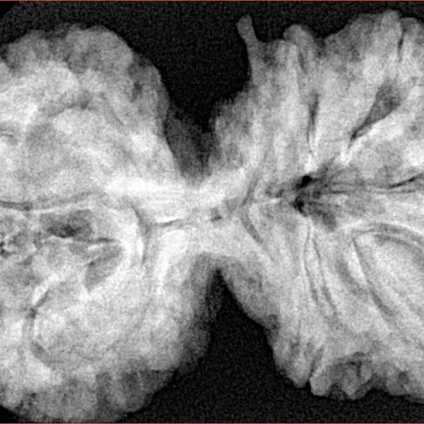 9 MK Gaurishankar 40.3mm 9.7gm - Xray