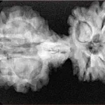 10 Mukhi Mini Trijuti 38.7mm 6.25gm - Xray
