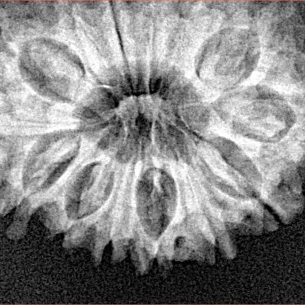 14 Mukhi Rudraksha 27.4mm 3.78gm - Xray