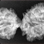 16 Mukhi Gaurishankar 37.8mm 5.25gm - Origin: Nepal - Xray