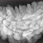 1 Mukhi Rudraksha 35.4mm 6gm - Xray