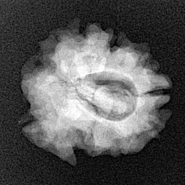 1 Mukhi Rudraksha 22.9mm 2.92gm - Xray