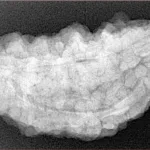 1 Mukhi Rudraksha 33.8mm 6.6gm - Xray