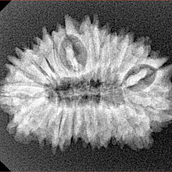 20 Mukhi Rudraksha 26.8mm 3gm - Xray