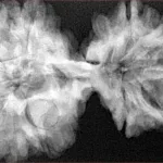 10 Mk Gaurishankar 40.1mm 8.13gm - Xray