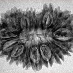 18 Mukhi Rudraksha 30.7mm 4.37gm - Inverse xray