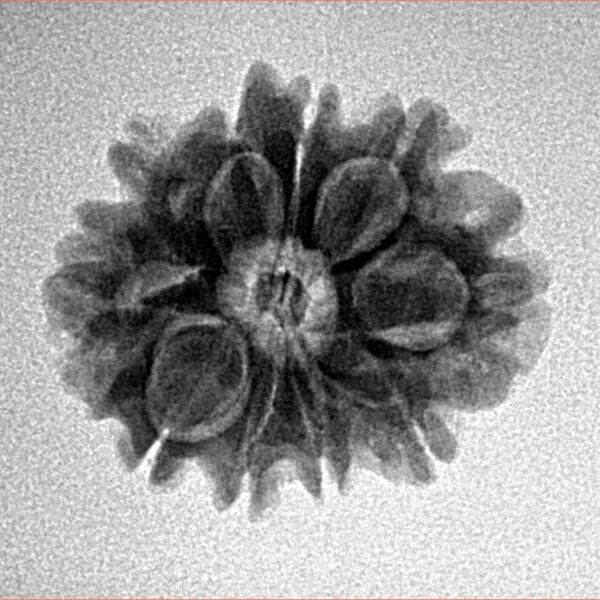 10 Mukhi Rudraksha 21.3mm 2.77gm - Inverse xray