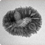 18 Mukhi Rudraksha 22.9mm 2.61gm - Inverse xray
