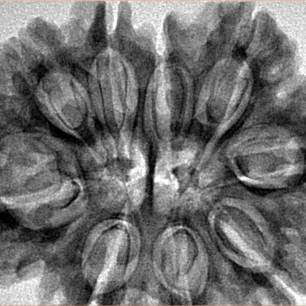 9 MK Gaurishankar 33.8mm 7.16gm - Inverse xray