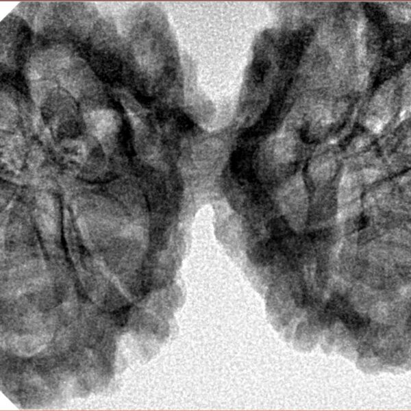 10 Mk Gaurishankar 44.6mm 8.32gm - Inverse xray