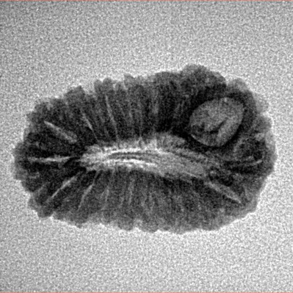18 Mukhi Rudraksha 22.9mm 2gm - Inverse xray