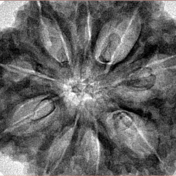 9 Mukhi Rudraksha 34.9mm 9.42gm - Inverse xray