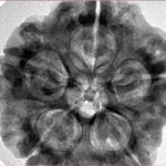 5 Mukhi Rudraksha 29.6mm 8.93gm - Inverse xray