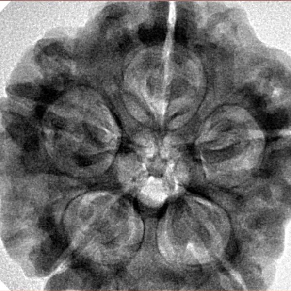 5 Mukhi Rudraksha 29.6mm 8.93gm - Inverse xray