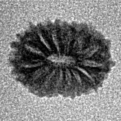 14 Mukhi Rudraksha 11.2mm 0.35gm - Inverse xray