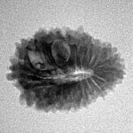 20 Mukhi Rudraksha 20.9mm 1.99gm - Inverse xray