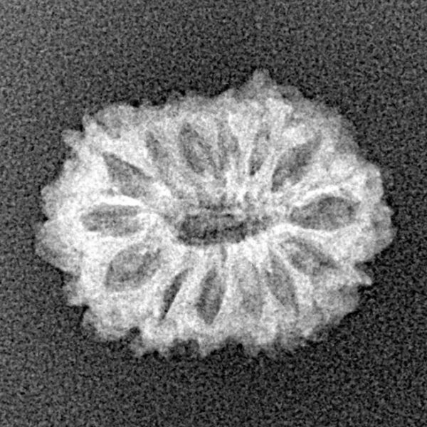 14 Mukhi Rudraksha 17.9mm 1.12gm - Xray