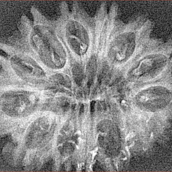 14 Mukhi Rudraksha 31.3mm 2.77gm - Xray