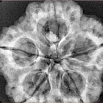 5 Mukhi Rudraksha 29.9mm 7.11gm - Xray