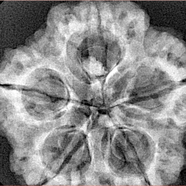 5 Mukhi Rudraksha 29.9mm 7.11gm - Xray