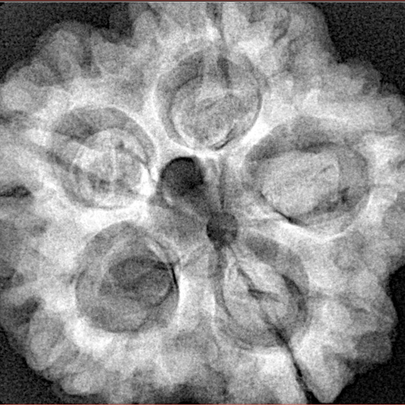 5 Mukhi Rudraksha 29.7mm 7.89gm - Origin: Nepal - Xray