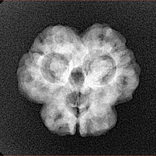 3 Mukhi Rudraksha 23mm 3.25gm - Xray