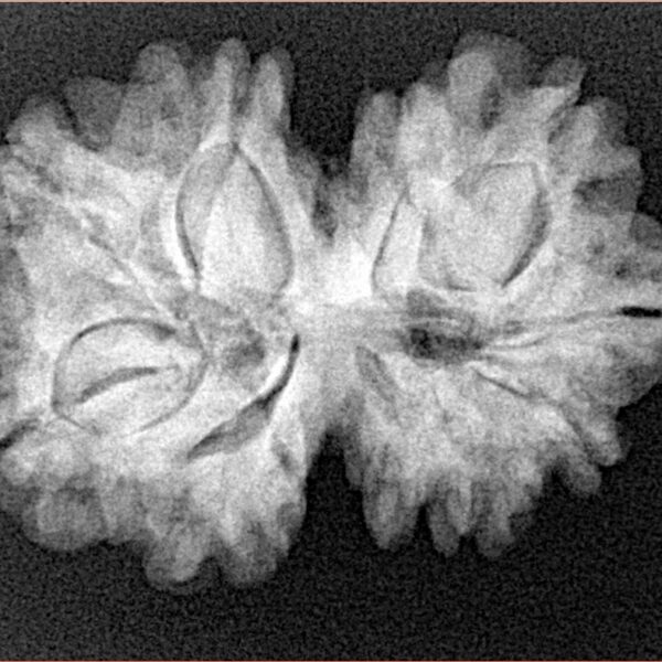 11 Mukhi G.S & Ganesh 29.1mm 5.08gm - Xray