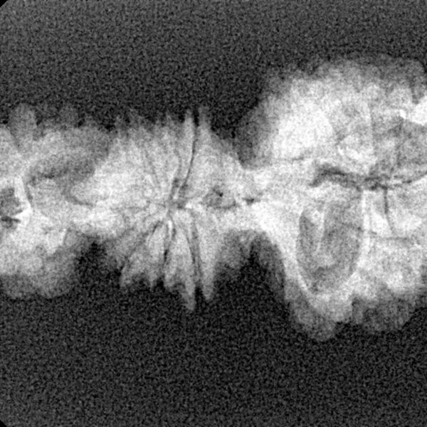 15 Mukhi Trijuti 31.8mm 2.35gm - Xray